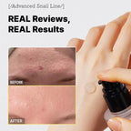Cosrx Snail 96 Mucin Power Essence.