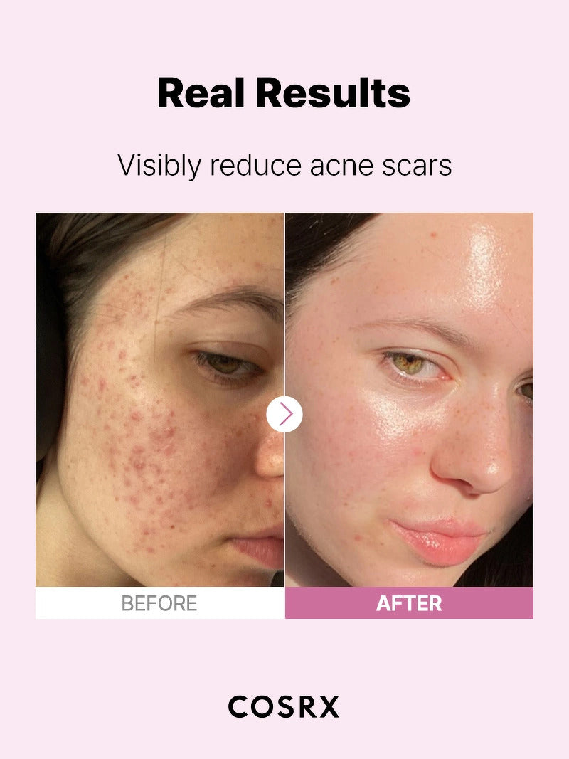 Cosrx Serum Niacinamida 15.
