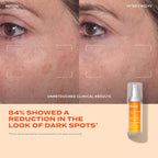 Murad Dark Spot Suero Corrector Rápido De Manchas Oscuras Con Acido Glicólico Y Tranexámico.