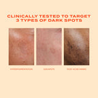 Murad Dark Spot Suero Corrector Rápido De Manchas Oscuras Con Acido Glicólico Y Tranexámico.
